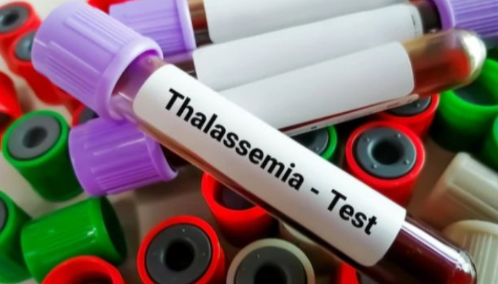 Penyakit Thalasemia Memiliki Sebab Kesalahan Genetik