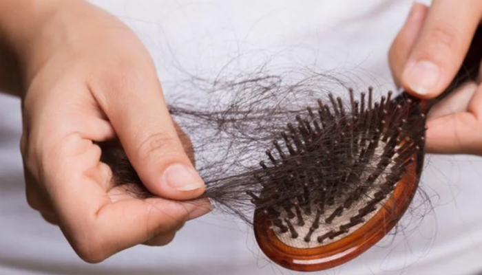 Rambut Rontok Terjadi Karena Beberapa Hal Kusus