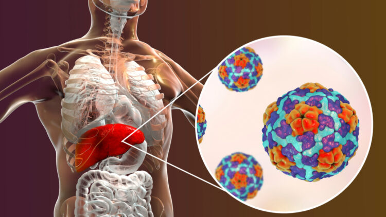 Penyakit Hepatomegali Memiliki Metode Pengobatan Teknologi