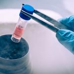 Cairan Stem Cell Bermanfaat Dalam Berbagai Kebutuhan Medis
